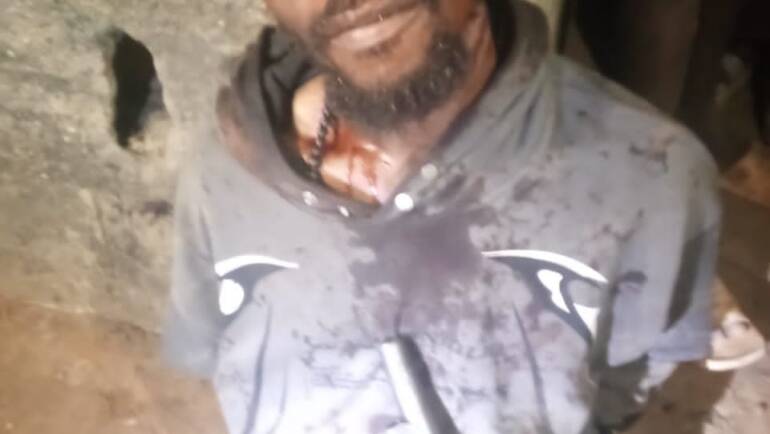So-Safe Apprehends Notorious Cultist, Recovers Arm